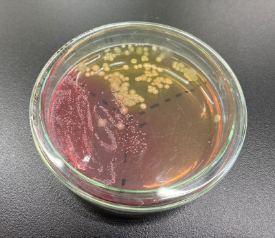 結果黄色ブドウ球菌